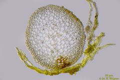 Hemitrichia_calyculata-sporangium-HF_K.jpg