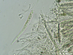Icmadophila_ericetorum-Ascus-a_K.jpg