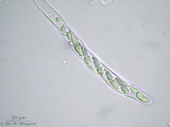 Icmadophila_ericetorum-Ascus-c_K.jpg