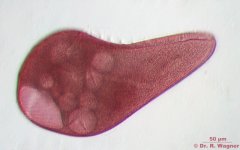 Blepharisma-10_K.jpg