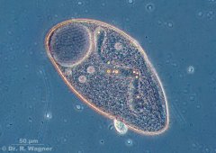 Blepharisma-7864_K.jpg