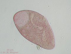 Blepharisma-7868_K.jpg