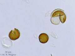 Equisetum_telmateia-Acetolyse_K.jpg