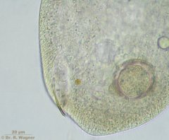 Frontonia_atra-ex_K.jpg
