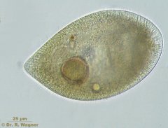 Frontonia_atra-ganz_K.jpg