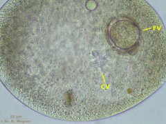 Frontonia_atra-vakuolen_K.jpg