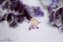 Kaulquappe-Birkenpollen_K.jpg