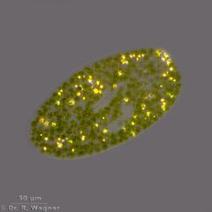 Paramecium_bursaria-Pol_K.jpg