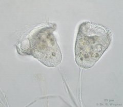 Pseudovorticella_monilata_K.jpg