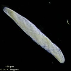 Spirostomum_ambiguum-100x-DF-a_K.jpg