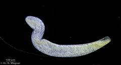 Spirostomum_ambiguum-100x-DF-b_K.jpg