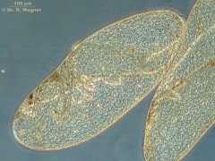 Spirostomum_ambiguum-100x_13_K.jpg