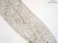 Spirostomum_ambiguum-200x_46_K.jpg