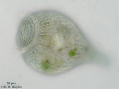 Stentor_coeruleus-B_K.jpg