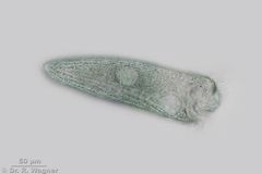 Stentor_coeruleus-Peringsmaar-400x_1237_K.jpg