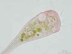 Stentor_igneus-26_K.jpg