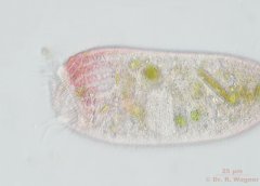 Stentor_igneus-43_K.jpg