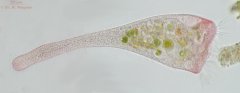 Stentor_igneus-stitch_K.jpg