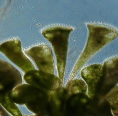Stentor_polymorphus-9844_K.jpg