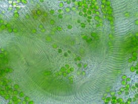Stentor_polymorphus-AZM-b_K.jpg
