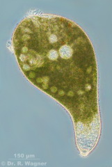 Stentor_polymorphus-phase-1_K.jpg