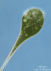 Stentor_polymorphus-phase-3_K.jpg