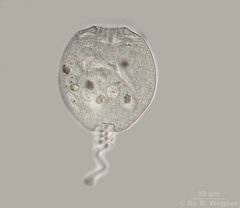 Vorticella_HF1_K.jpg