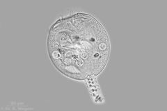 Vorticella_HF2_K.jpg
