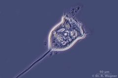 Vorticella_Phase_K.jpg