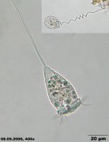 Vorticella_microstoma_K.jpg