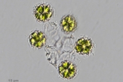 Coelastrum_reticulatum-1000x