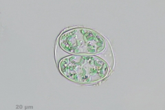 Glaucocystis