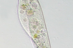 Paramecium-MoosTTeich-200xN_005-800